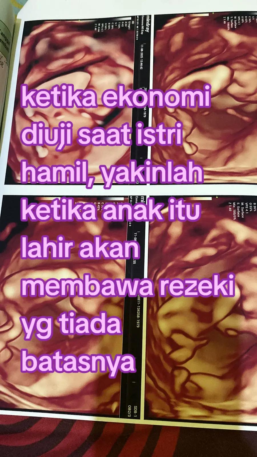@fiyon stevanus