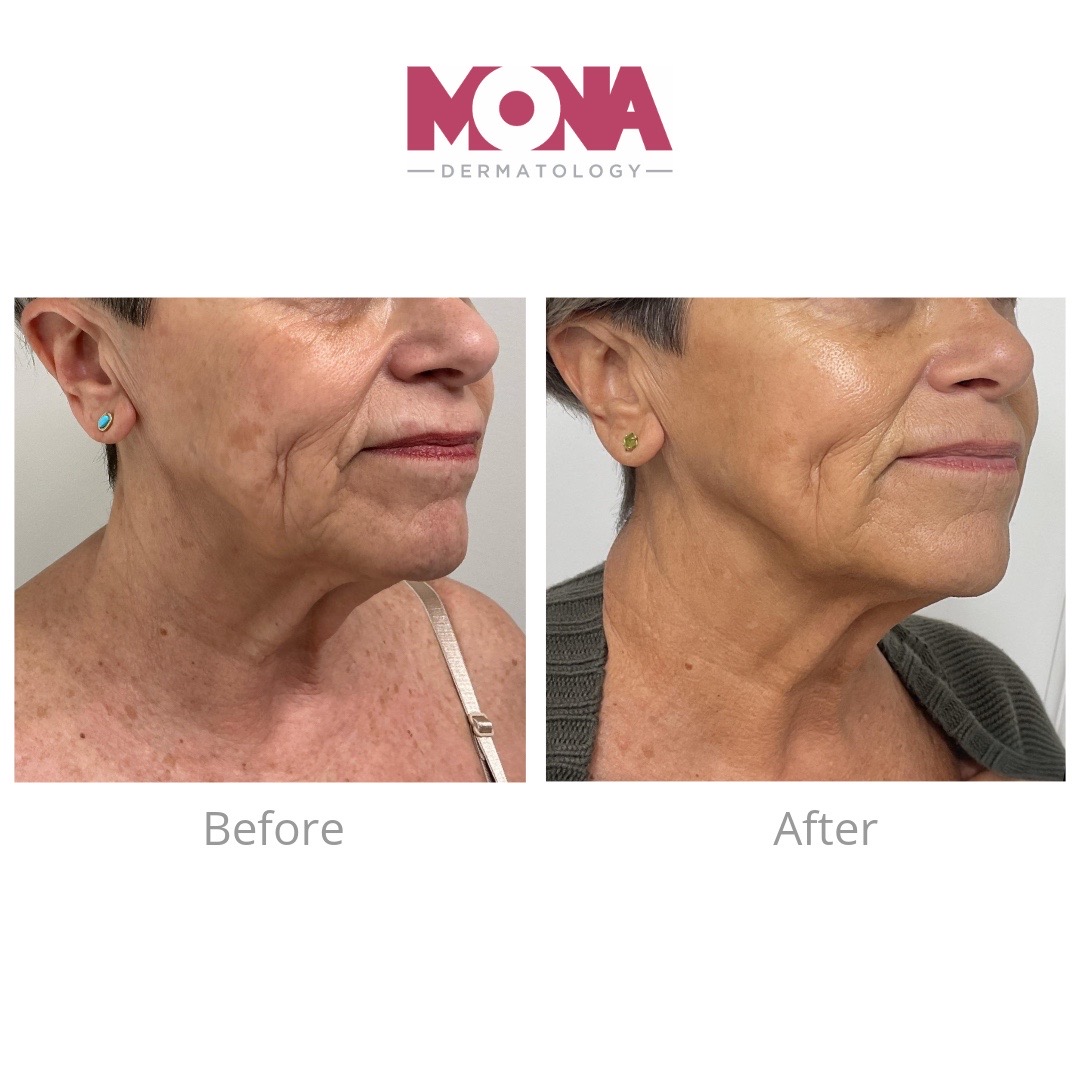 @Mona Dermatology | Cincinnati