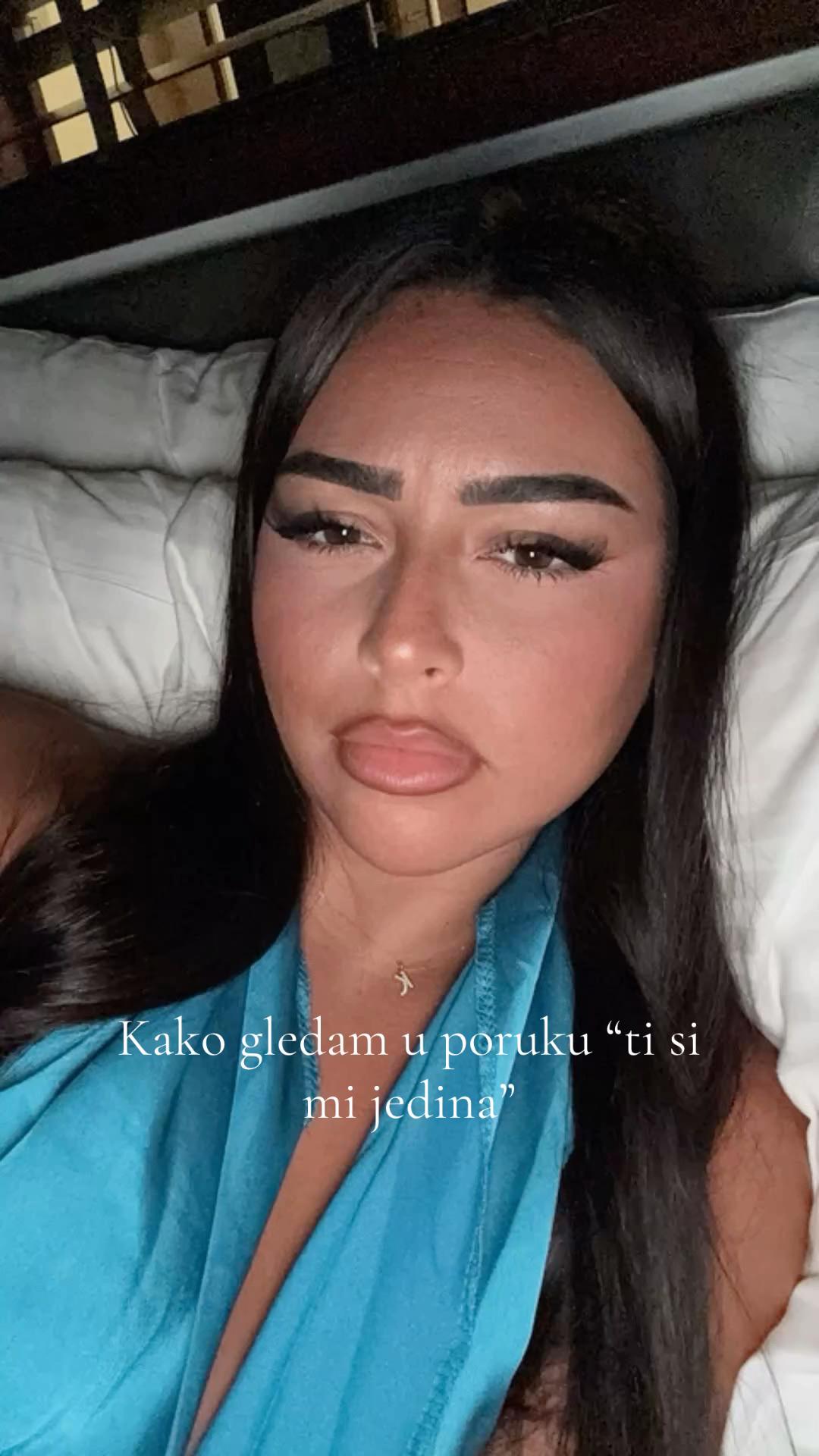 @555