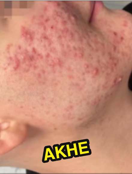 @💉👩🏻&zwj;⚕️ СкинТок Дерматолог