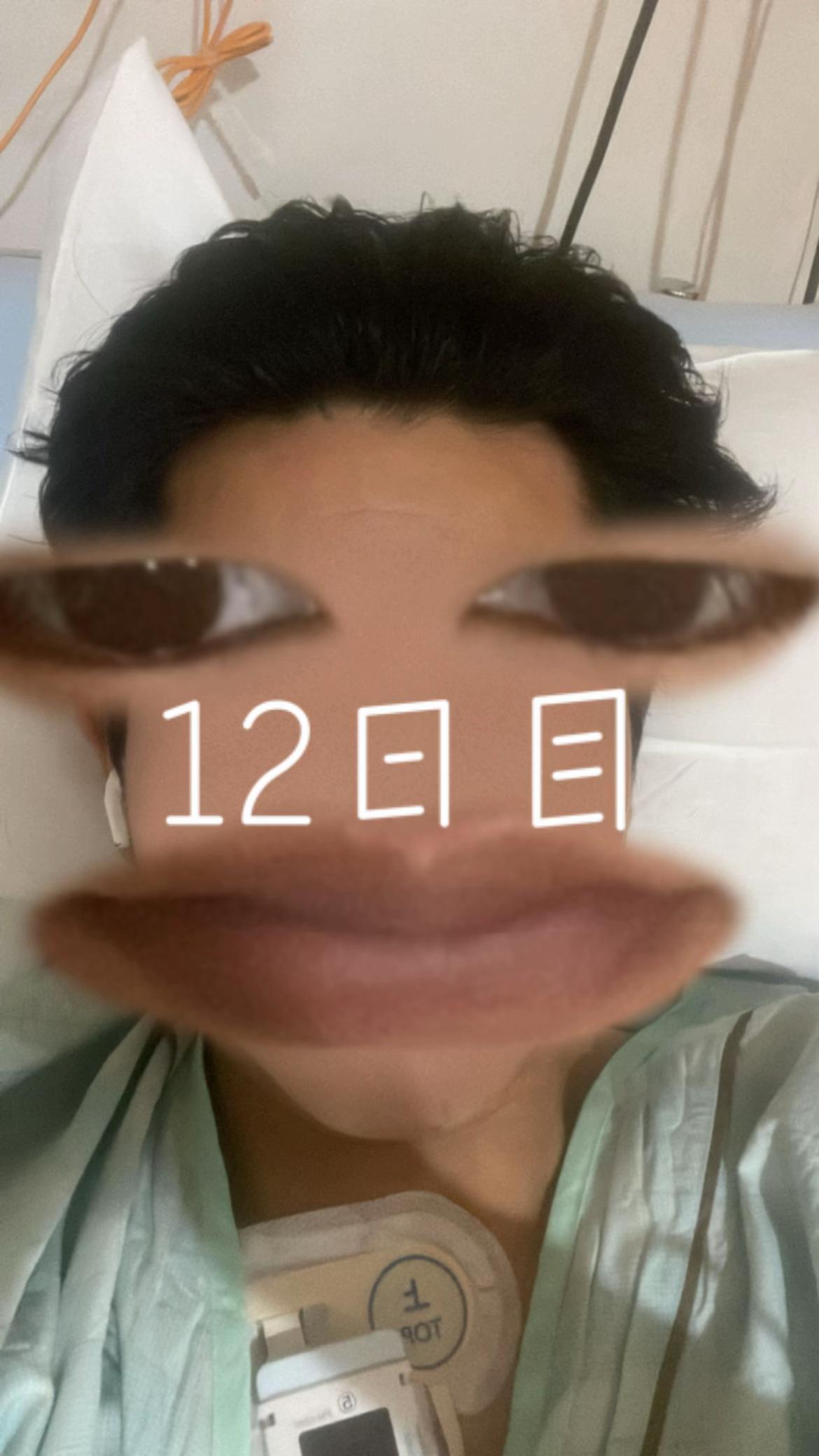@脊髄損傷から復活中の男
