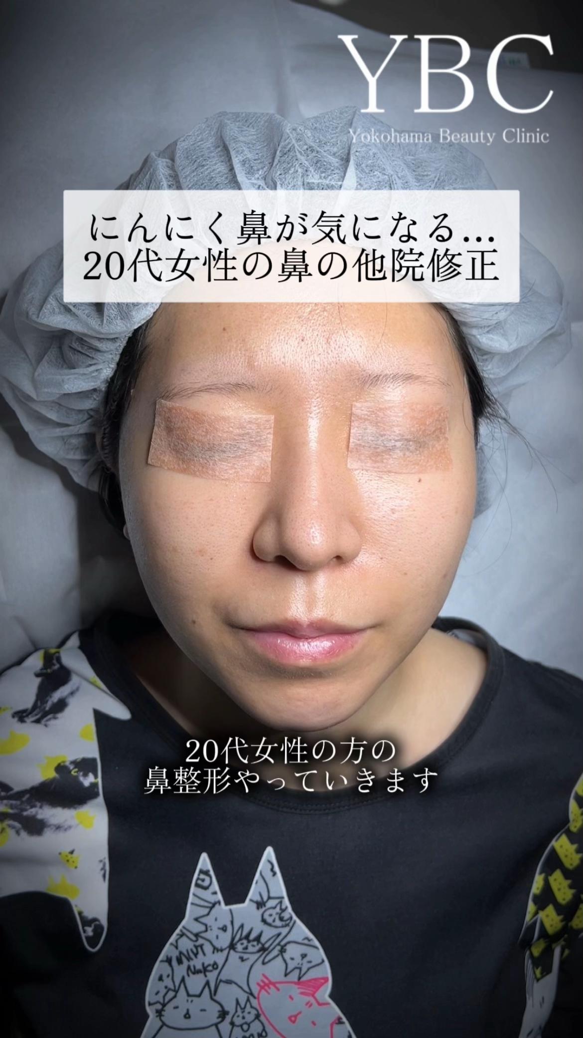 @イソセン/美容外科医（磯村亮輔院長）
