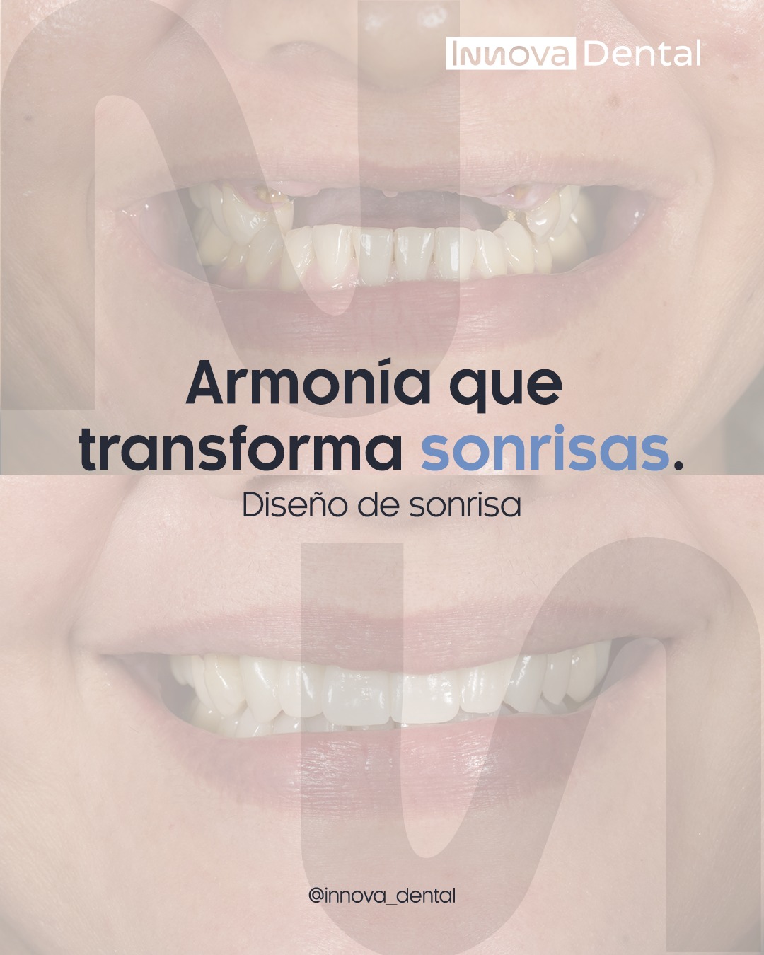 @Innova Dental Managua 🇳🇮