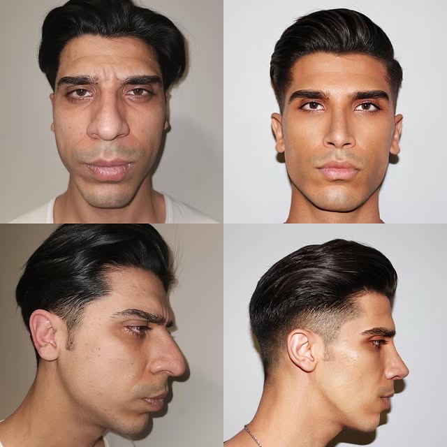 @Xue Skin & Contour