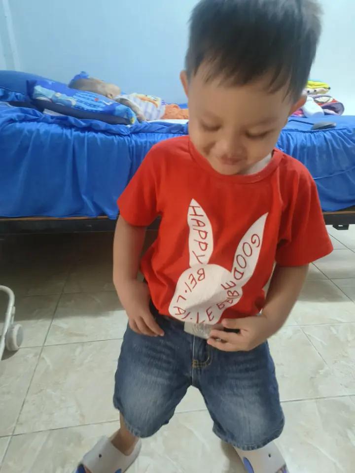 @บู้บี้เด็กหัวโตมีน้ำในโพรงสมอง