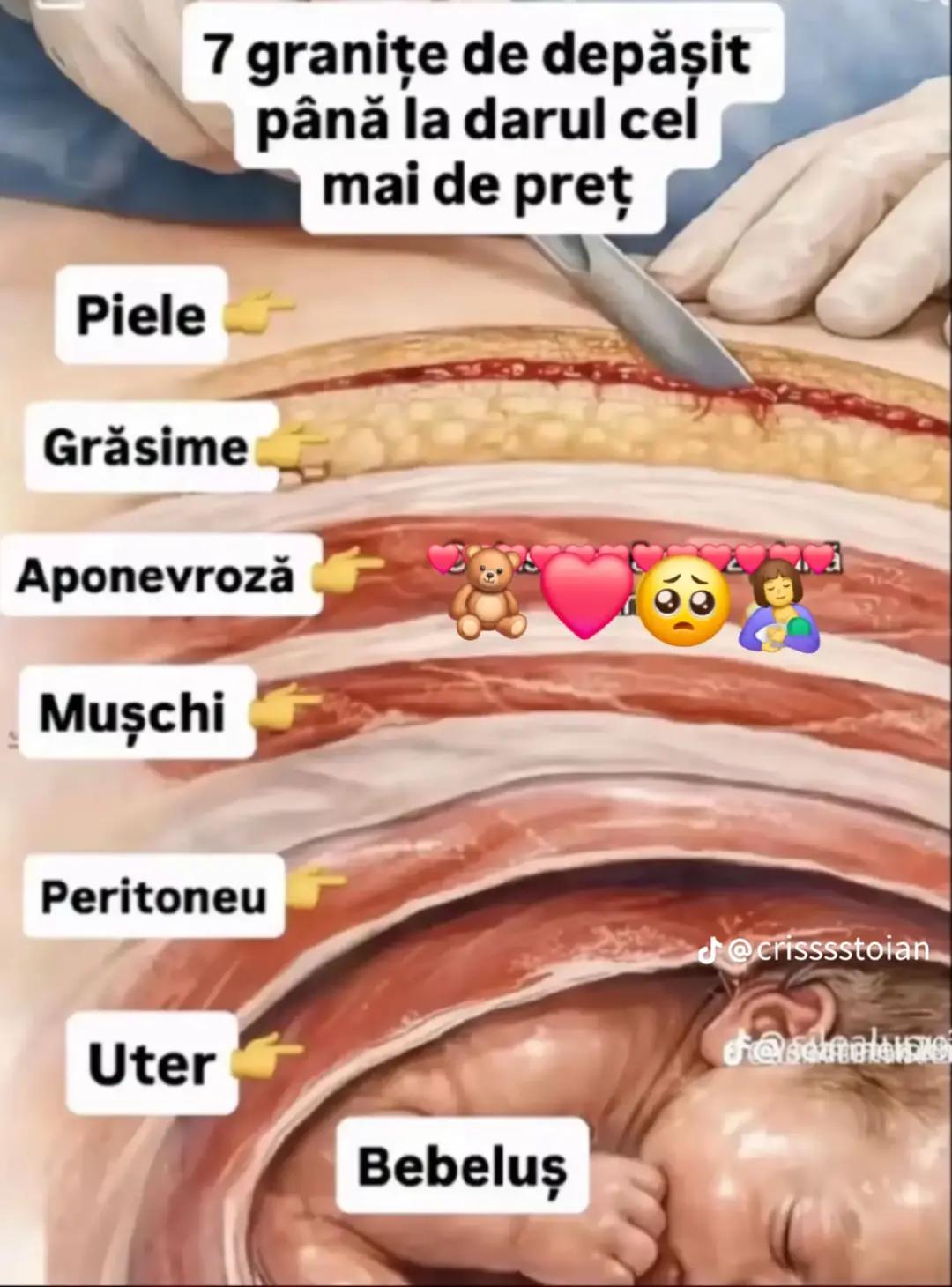 @Liliana Marin