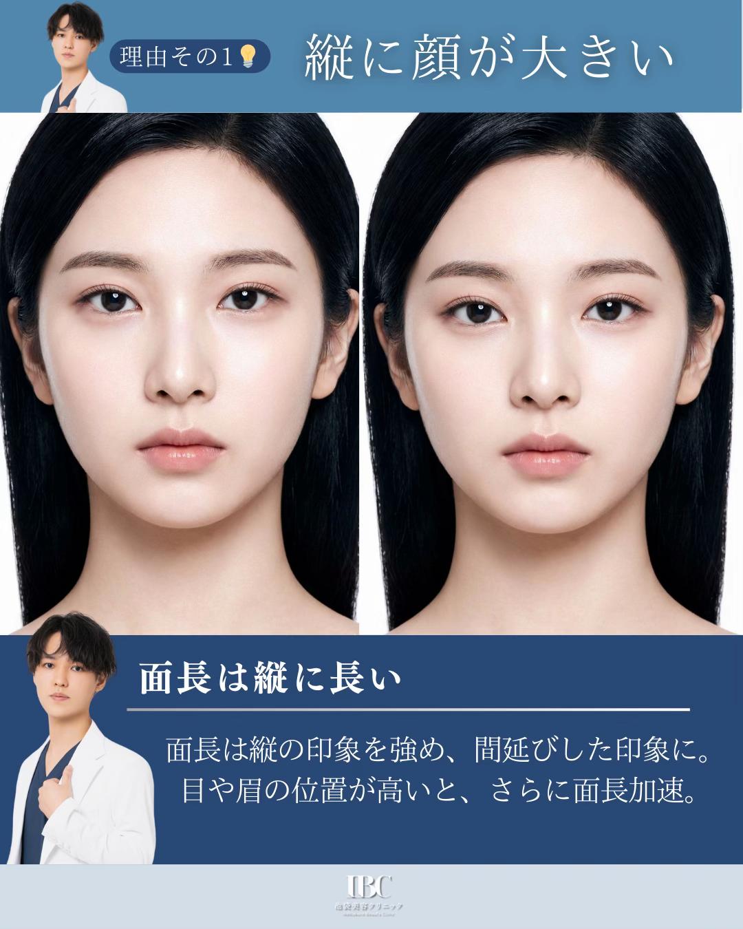 @高倉光平【タレ目形成×目尻切開】