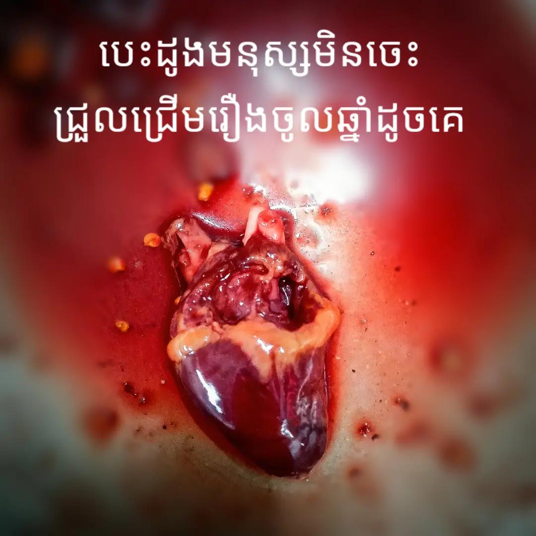 @Chea Chanthy-ជា ចន្ធី