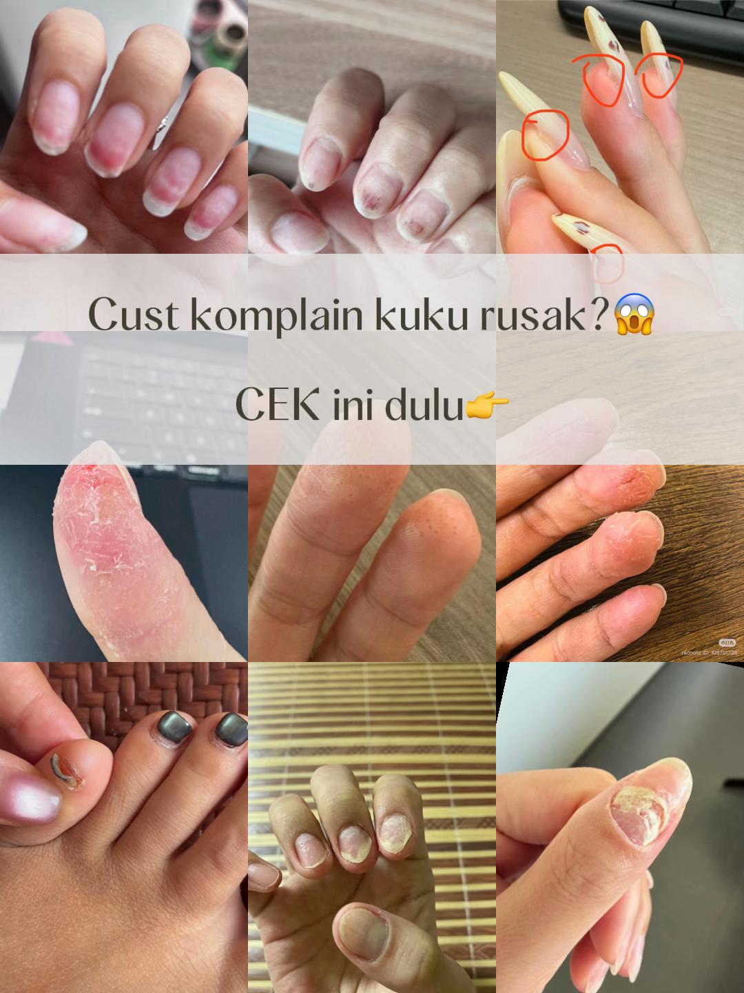 @💅🏻 Louis | Nail Diary