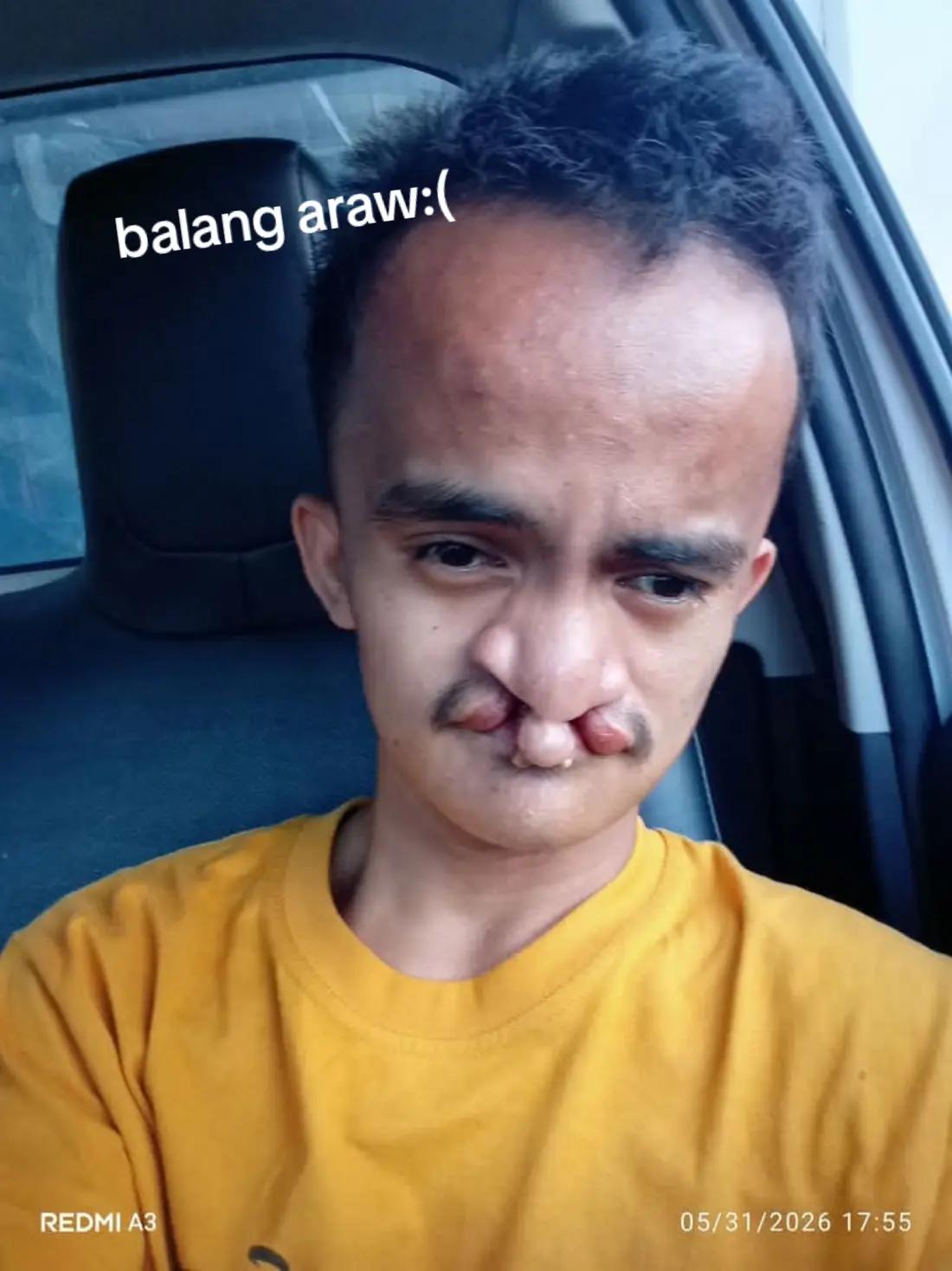 @🩷PWD Renskarl TEAMUNO🩷