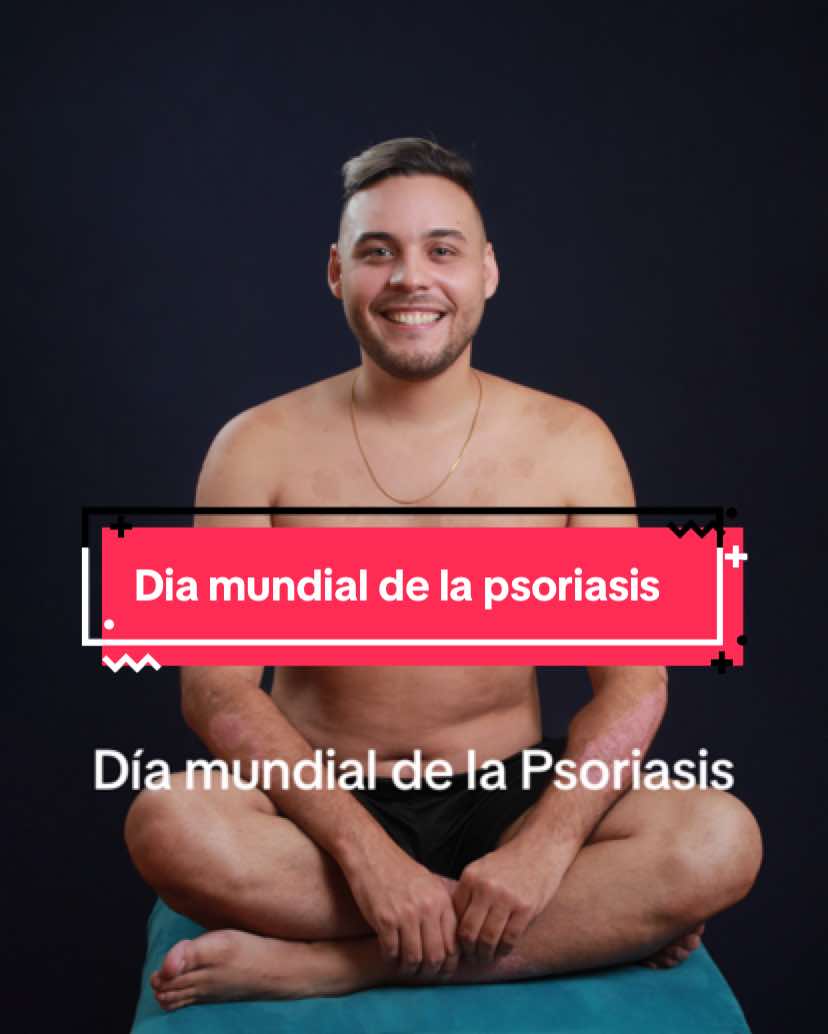 @Marwuin Demey