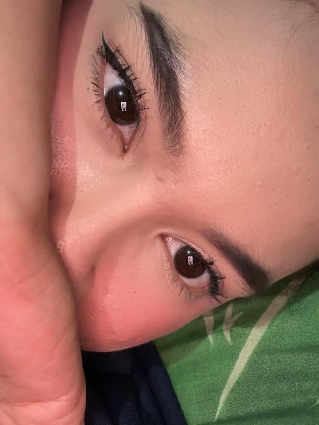 @XO