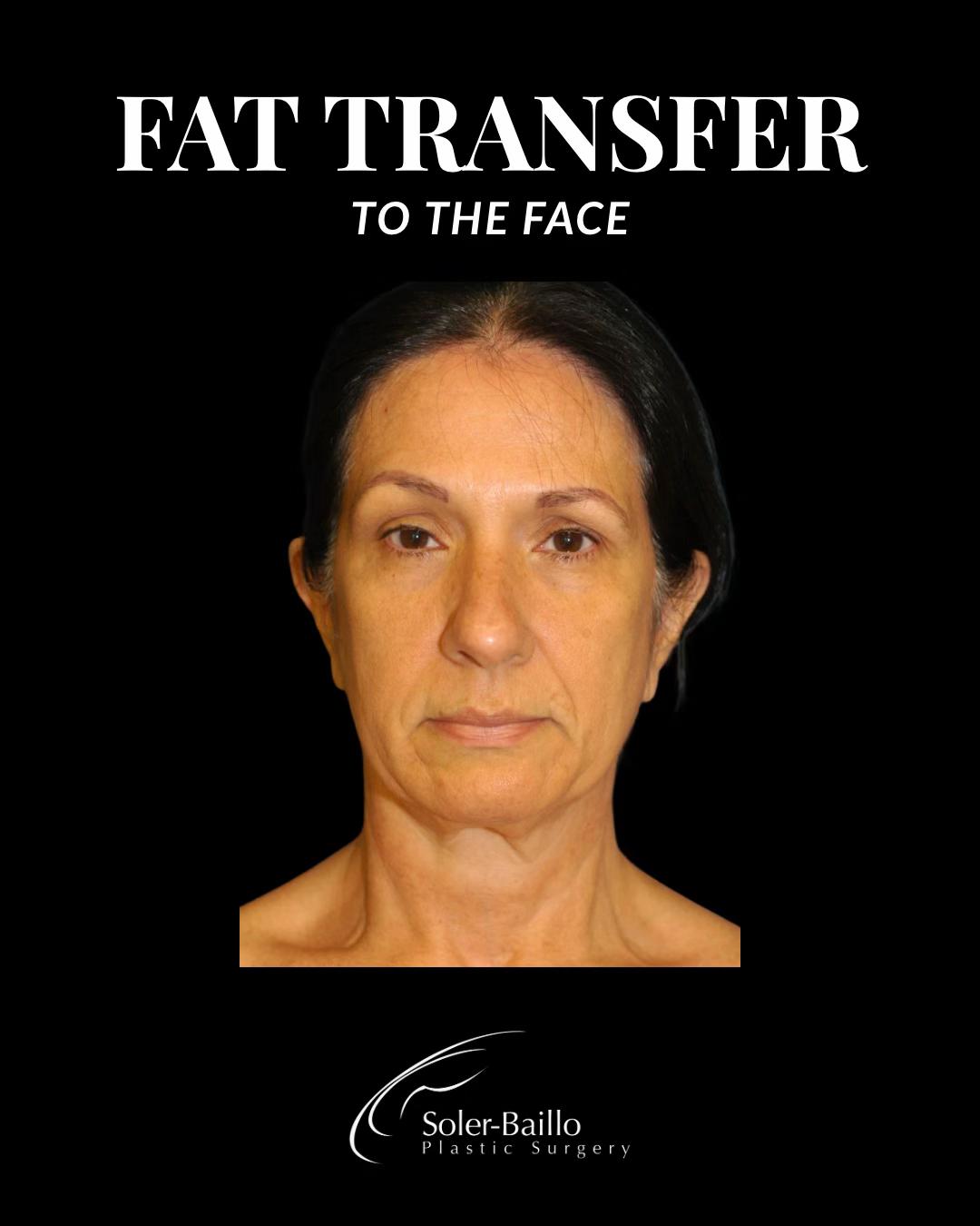 @Soler Baillo Plastic Surgery