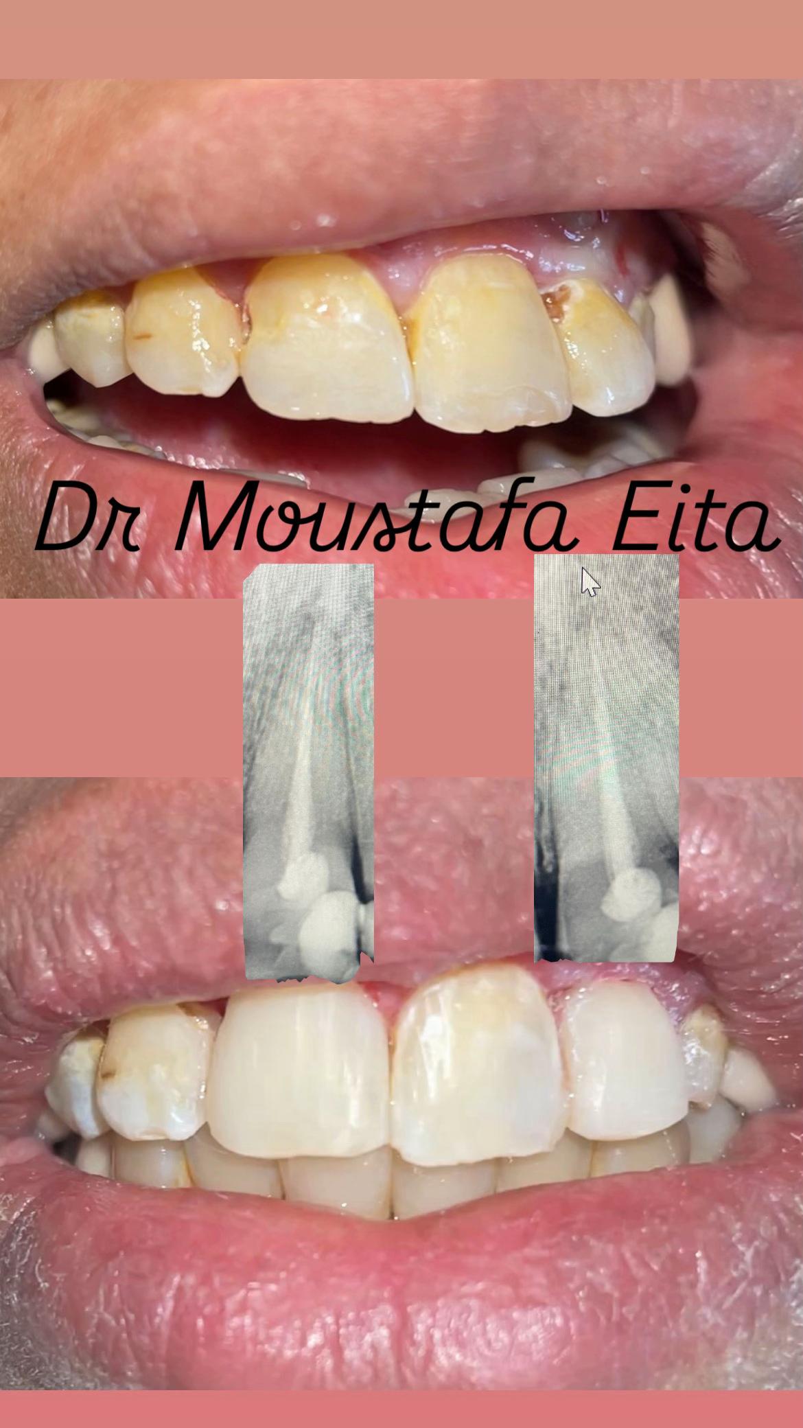 @Dr Mostafa Eita
