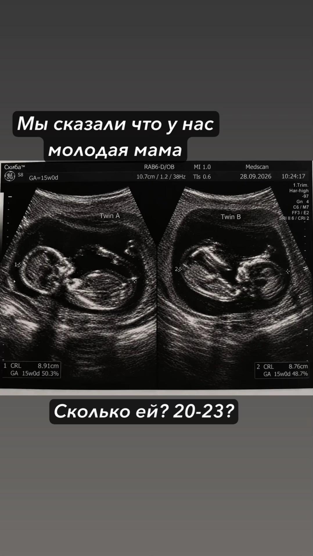 @Корейка на кости 🍖