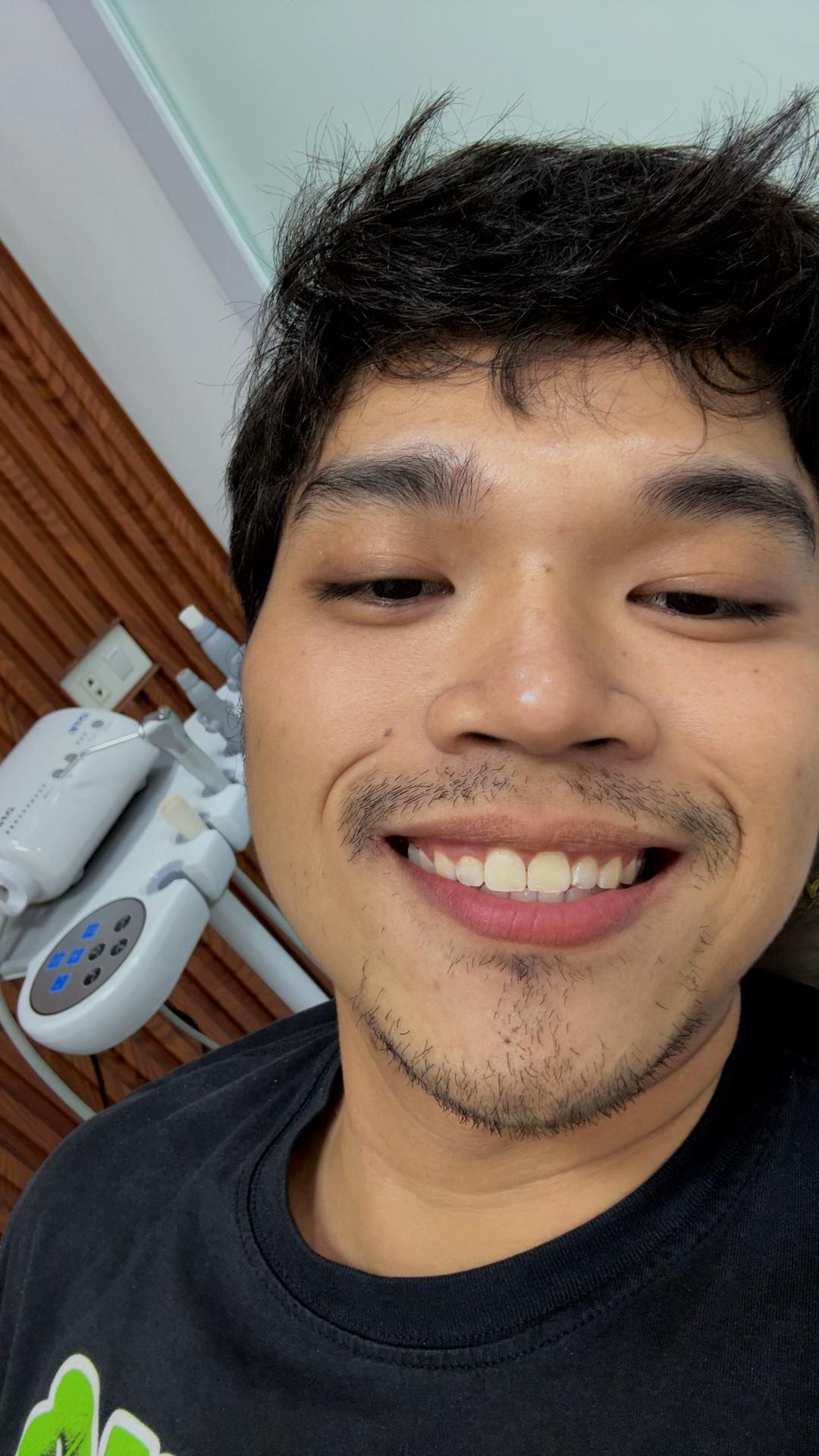 @Jhunpaps