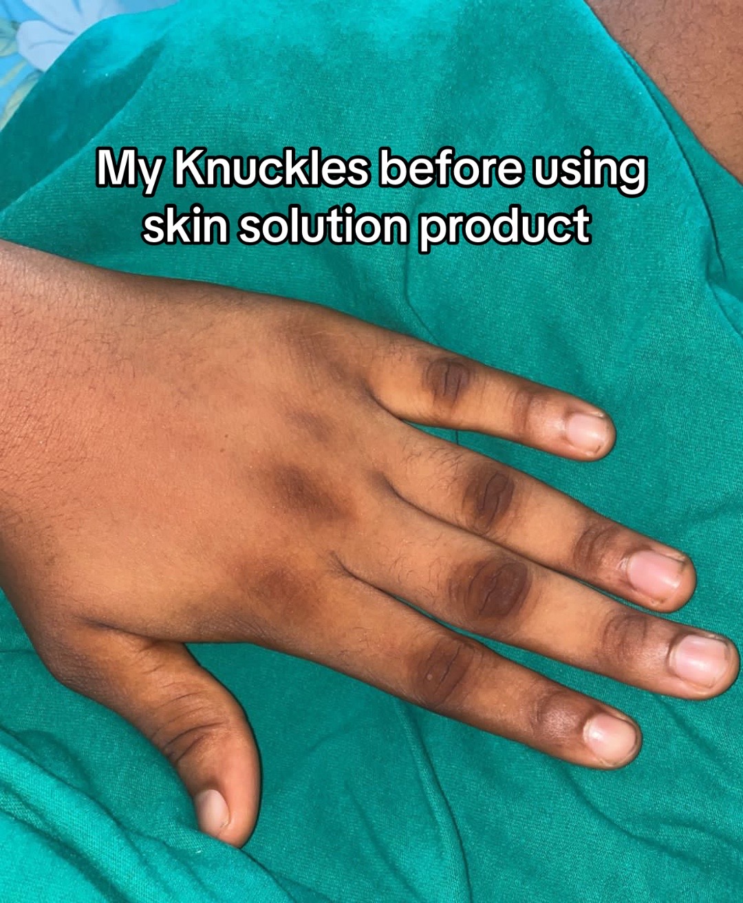 @Your skin solution🇳🇬🇬🇭🇬🇧