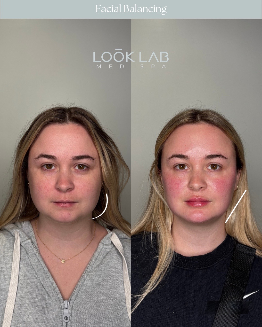 @Amanda | FL Aesthetic Injector