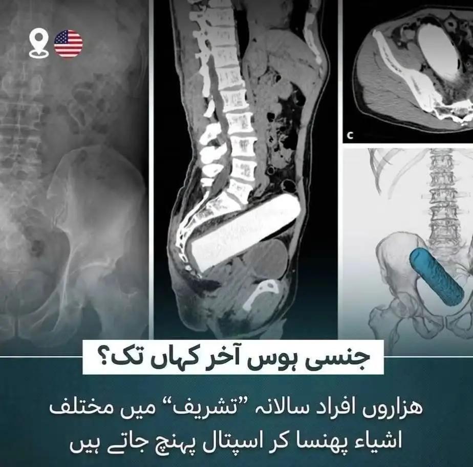 @غلام عباس 🗣️