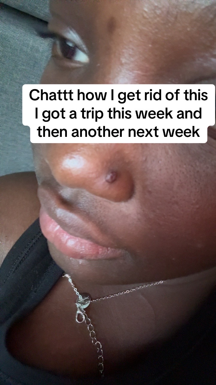 @Unknown User