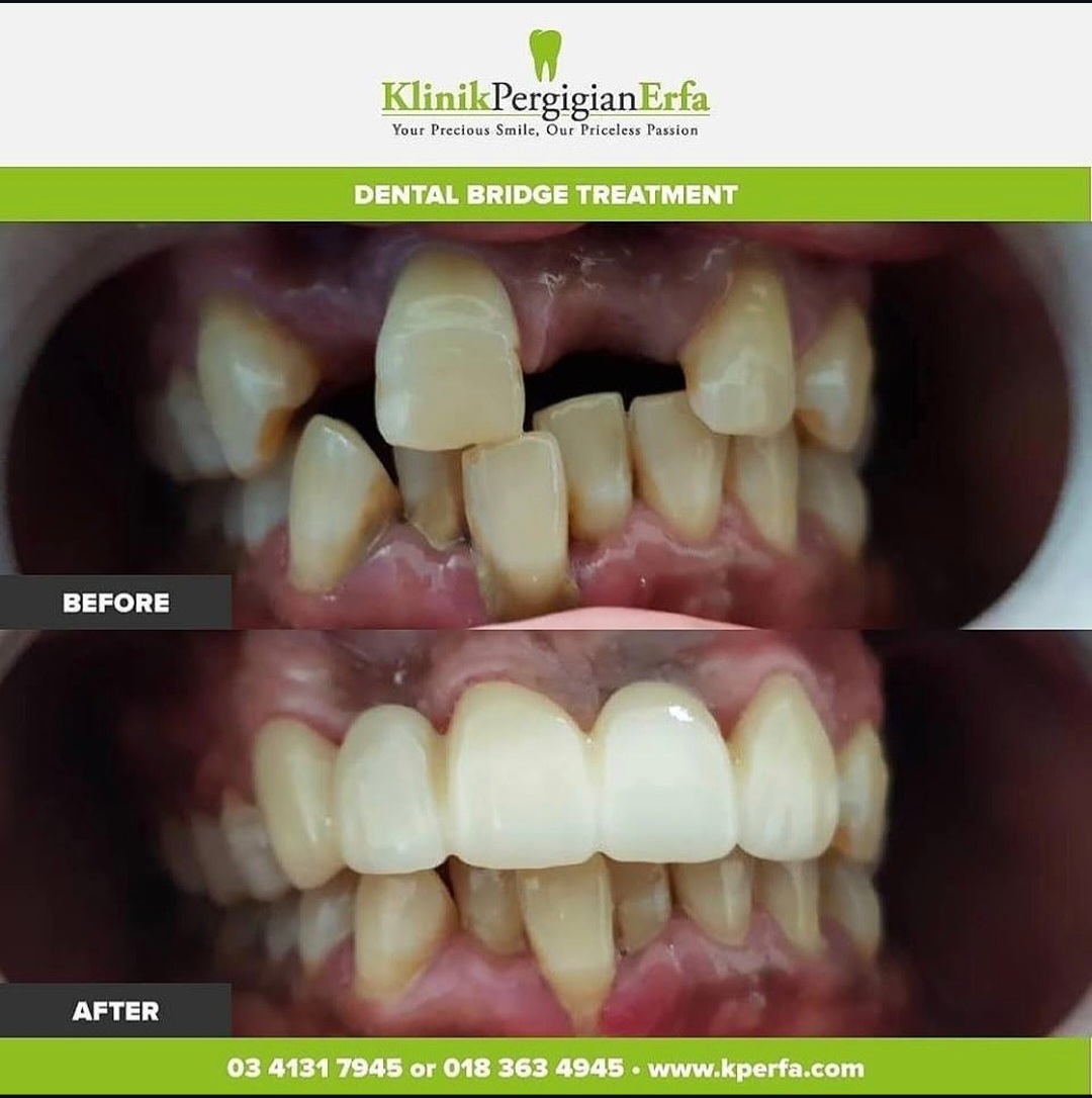 @Klinik Pergigian Erfa