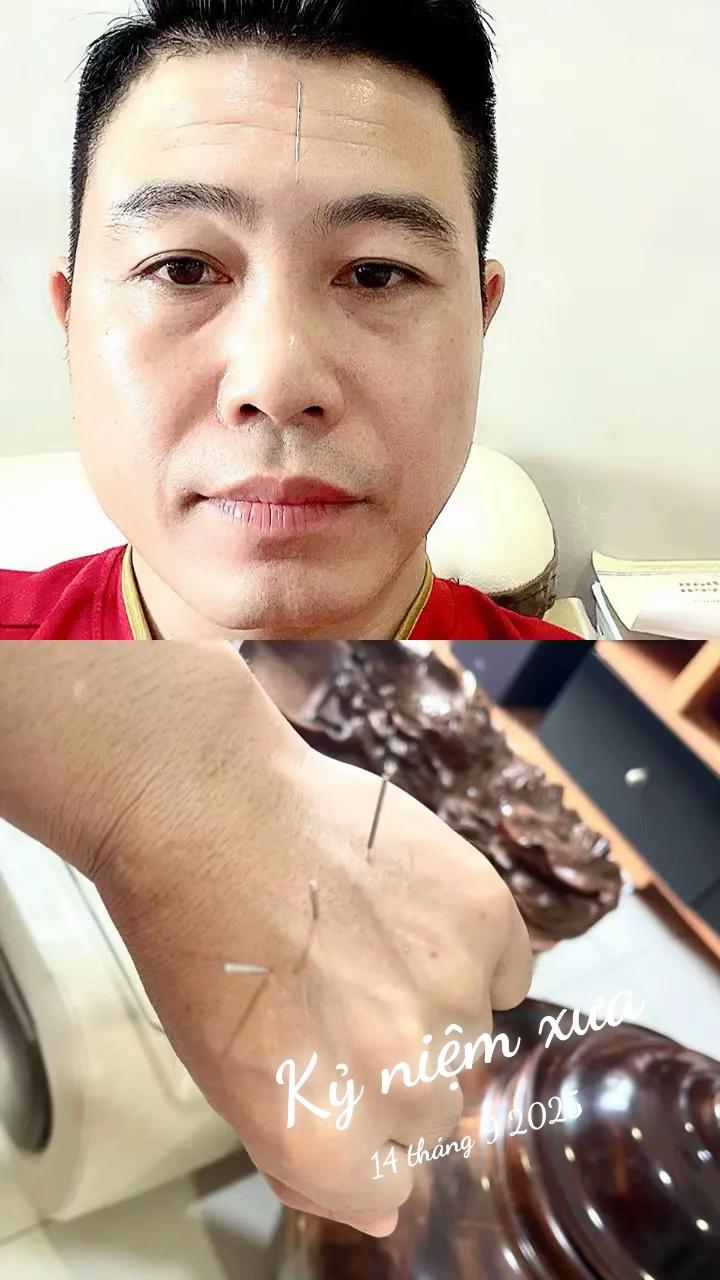 @Dr Nguyễn Hữu