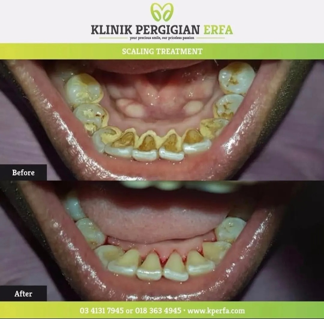 @Klinik Pergigian Erfa