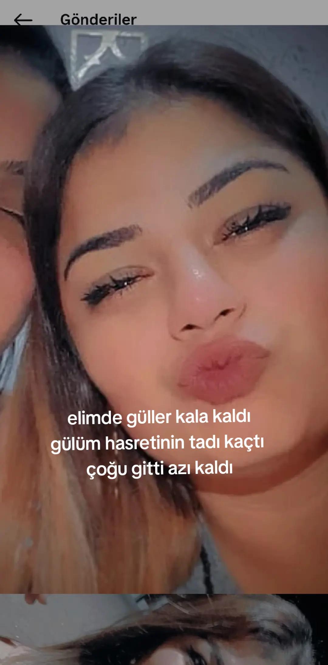 @《《♡D€|¡ K|Z♡》》