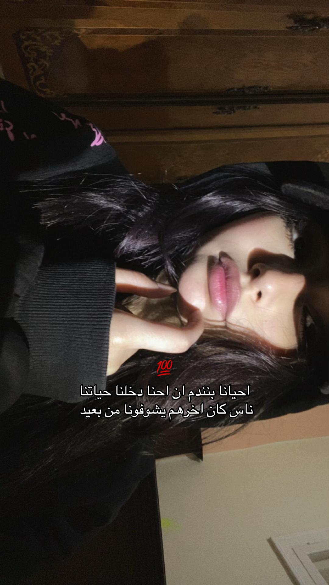 @َ