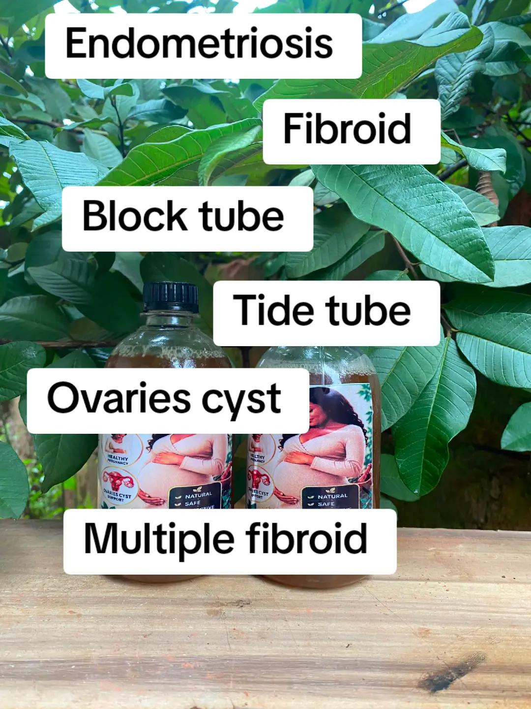 @omega fibroid removal herbs