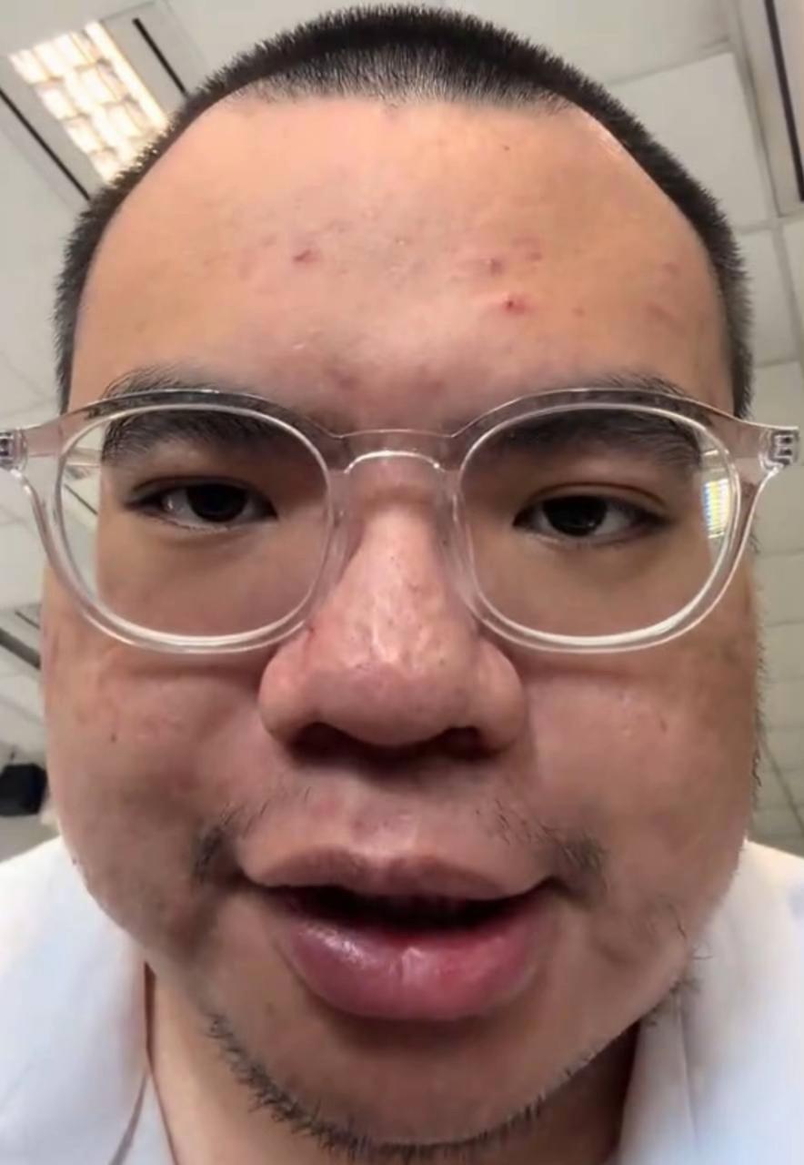 @GUO LAI RAGEBAIT FINAL BOSS