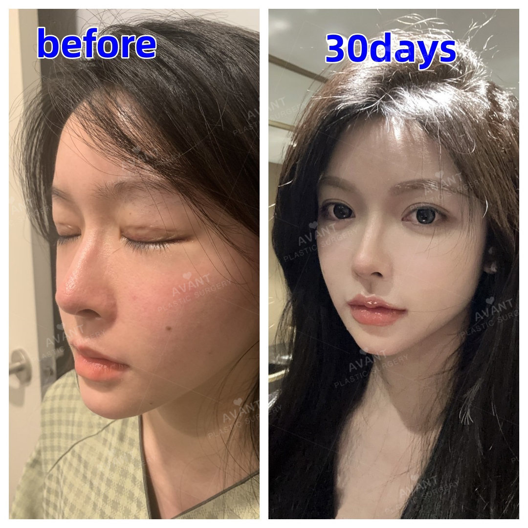 @Avant美容外科