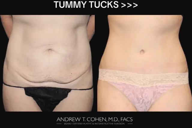 @Cohen MD Plastic Surgery