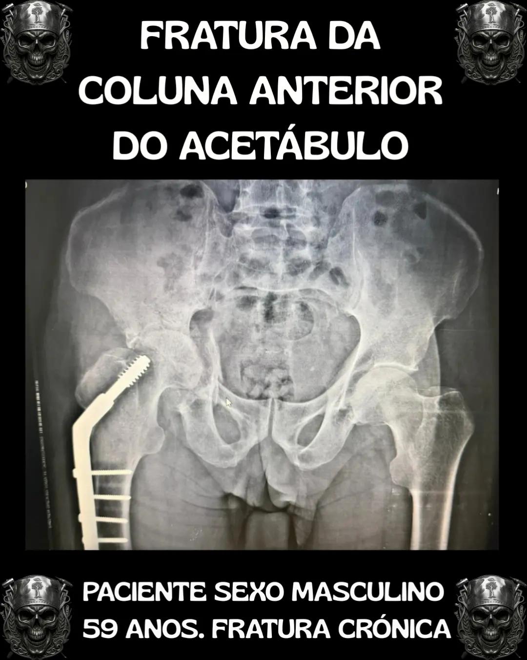 @Traumatologia Maluca