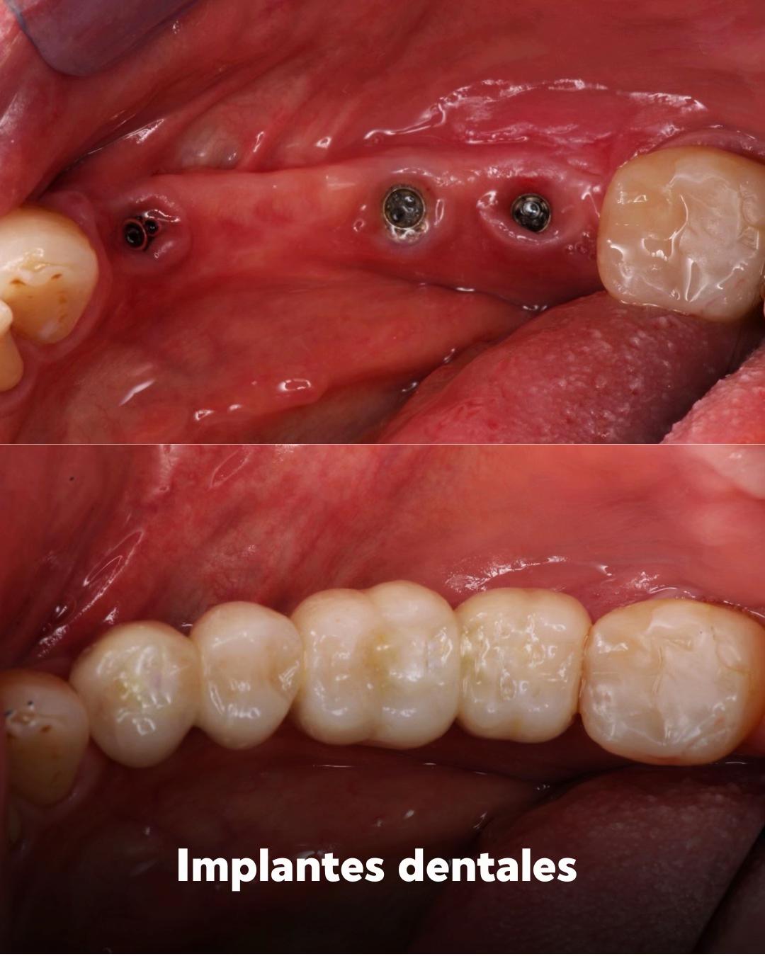 @Cava Cl&iacute;nica Dental 🦷