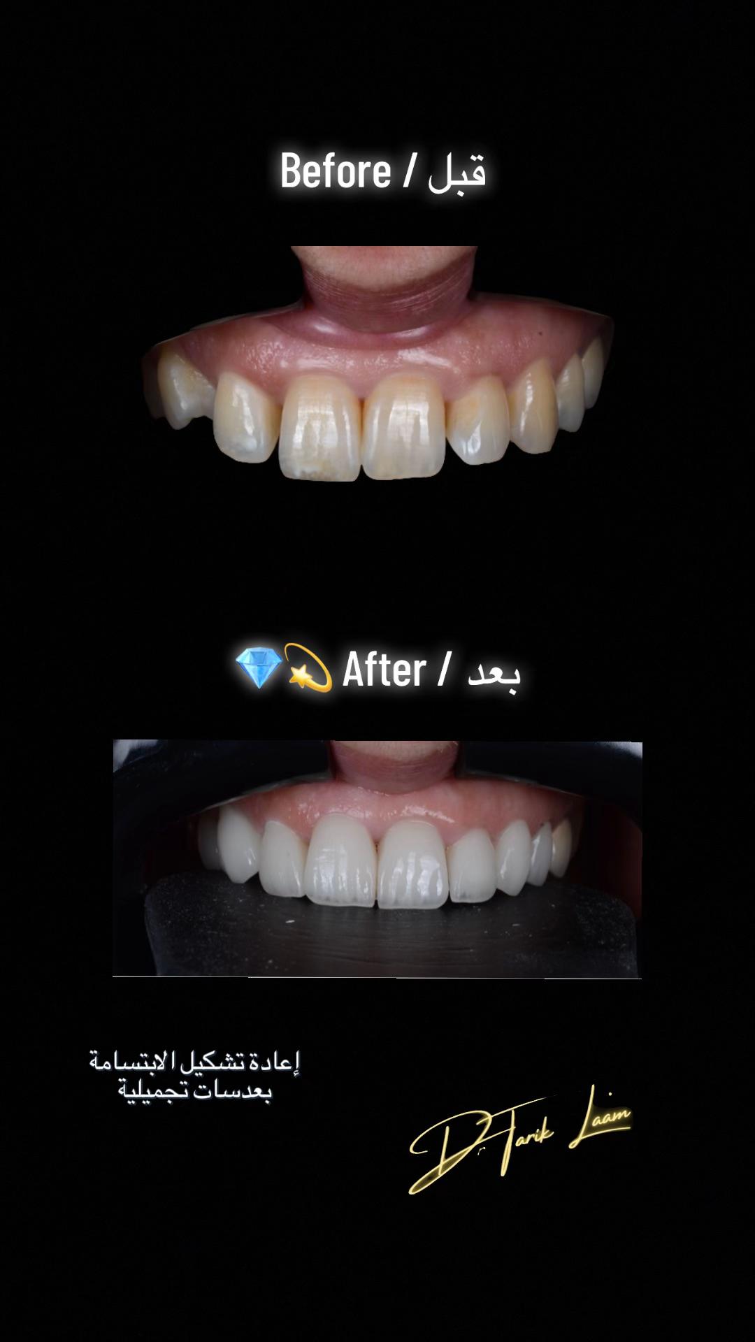 @Dr.tarik_laam