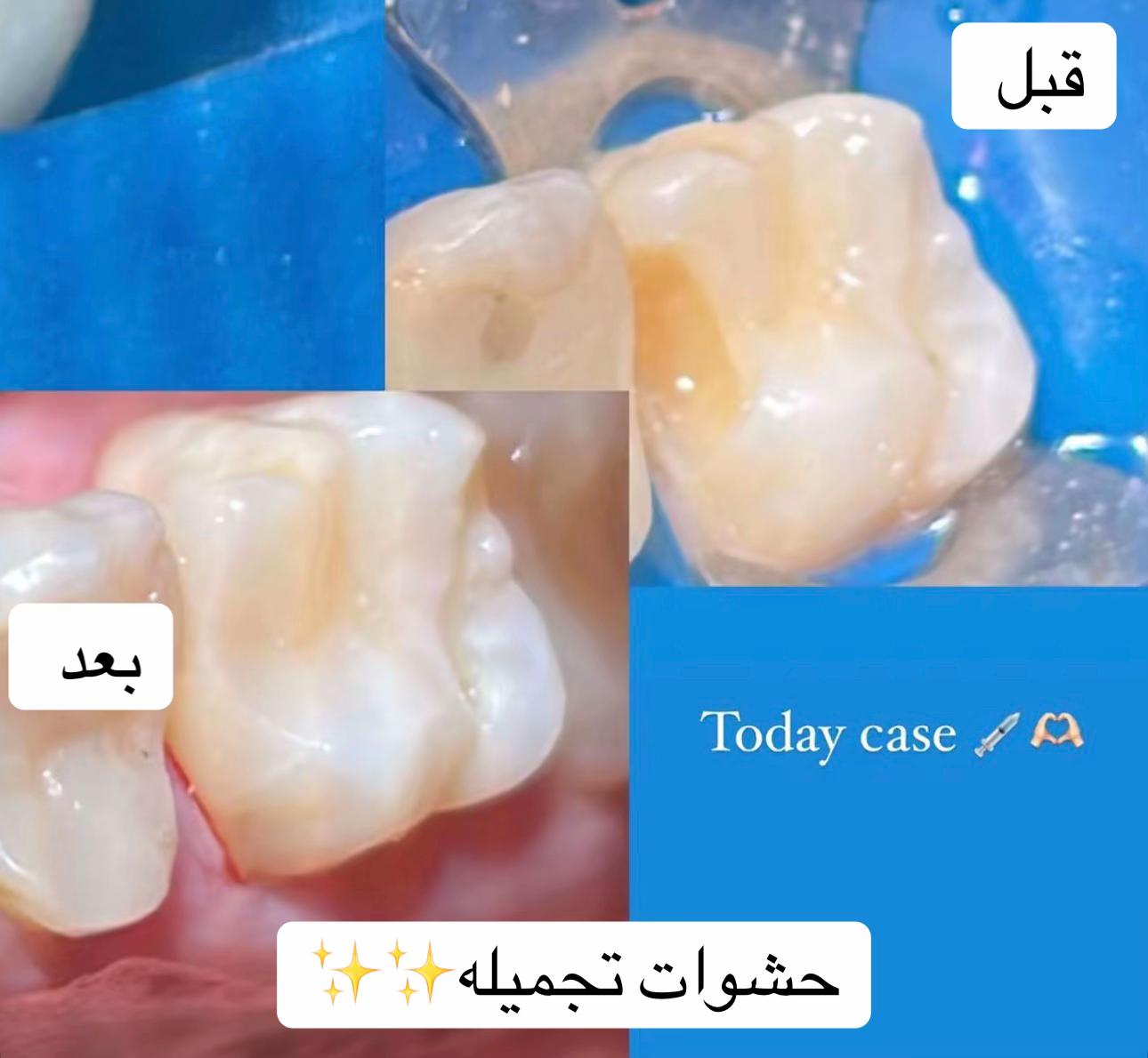 @د.لجين