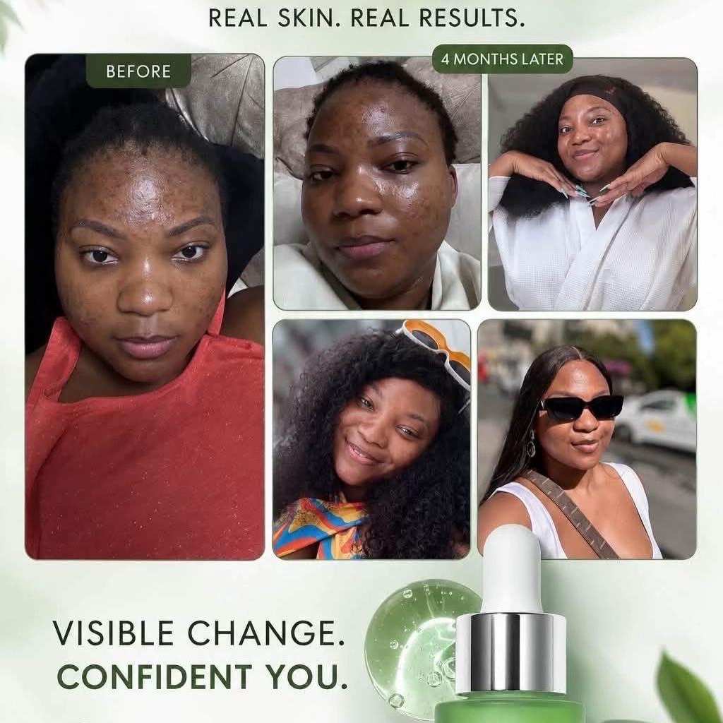 @🧴Marvell Skincare Benin city