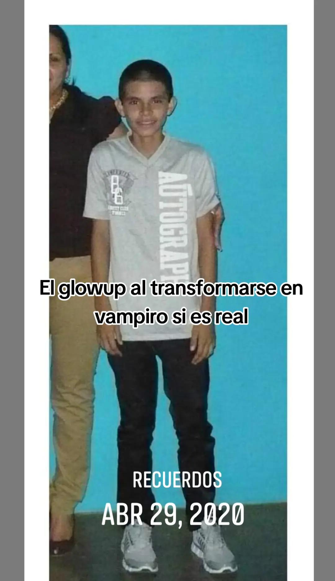 @GIO