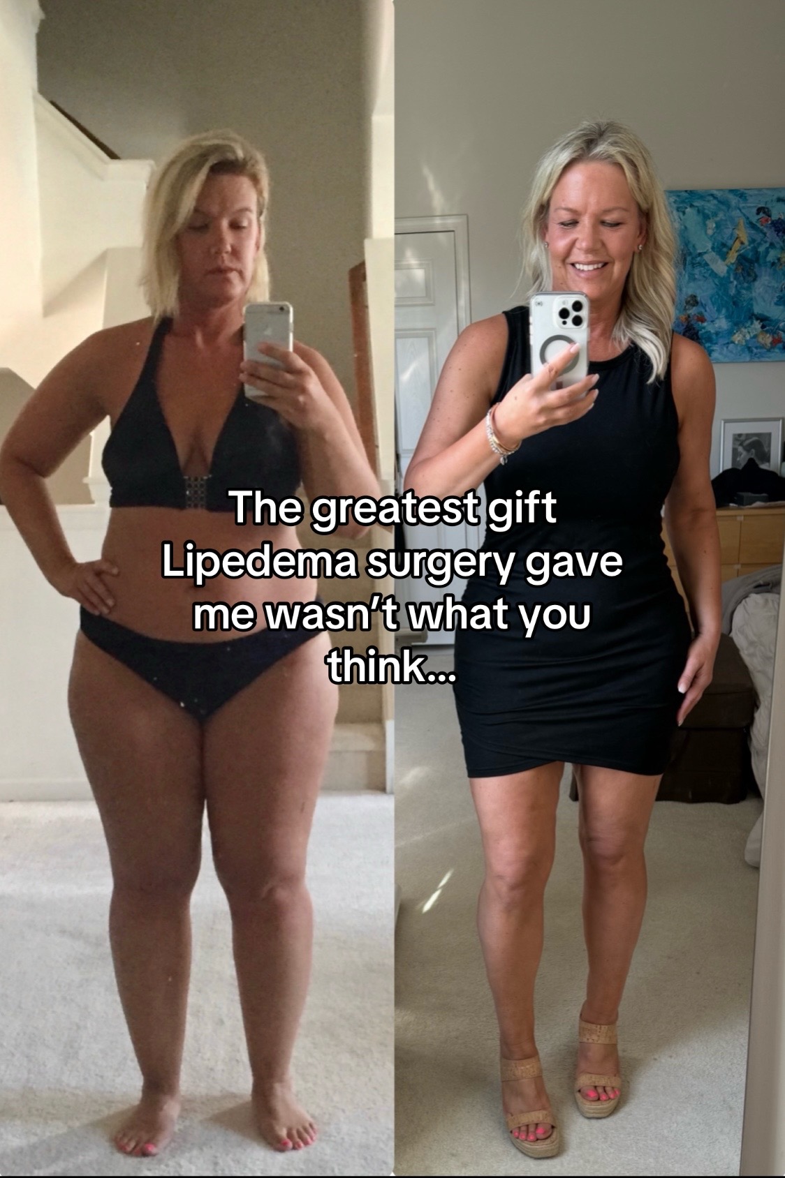 @Lipedema Warrior