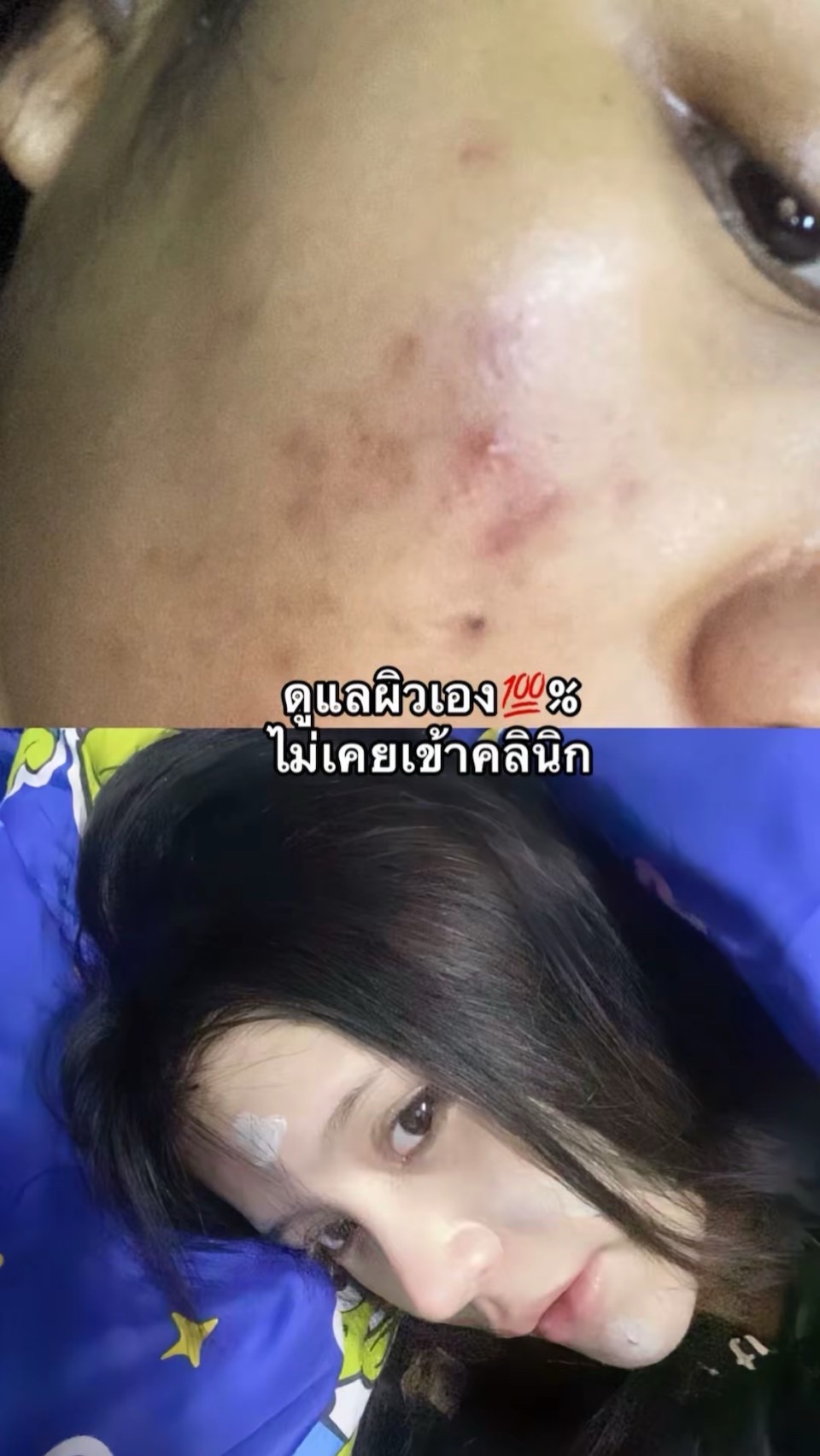 @รวิ