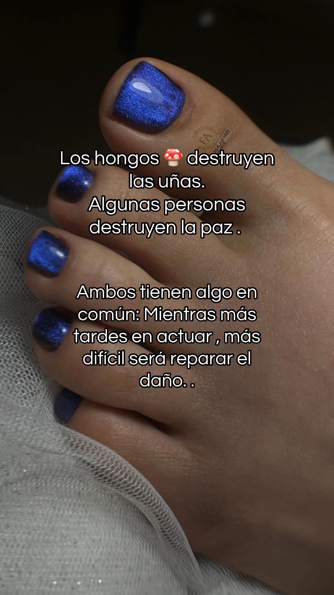 @Fer B