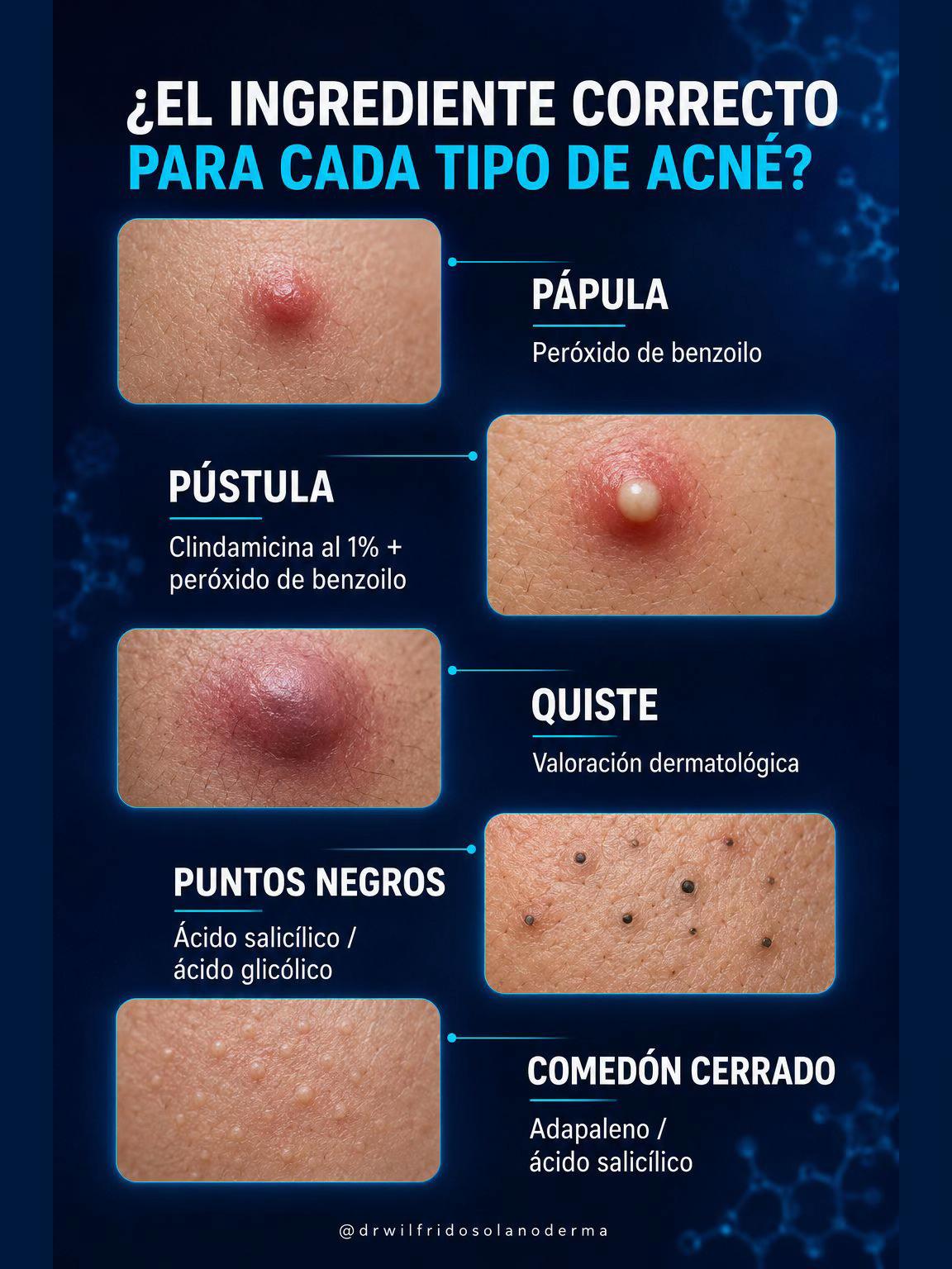 @Dr. Wilfrido Solano Derma