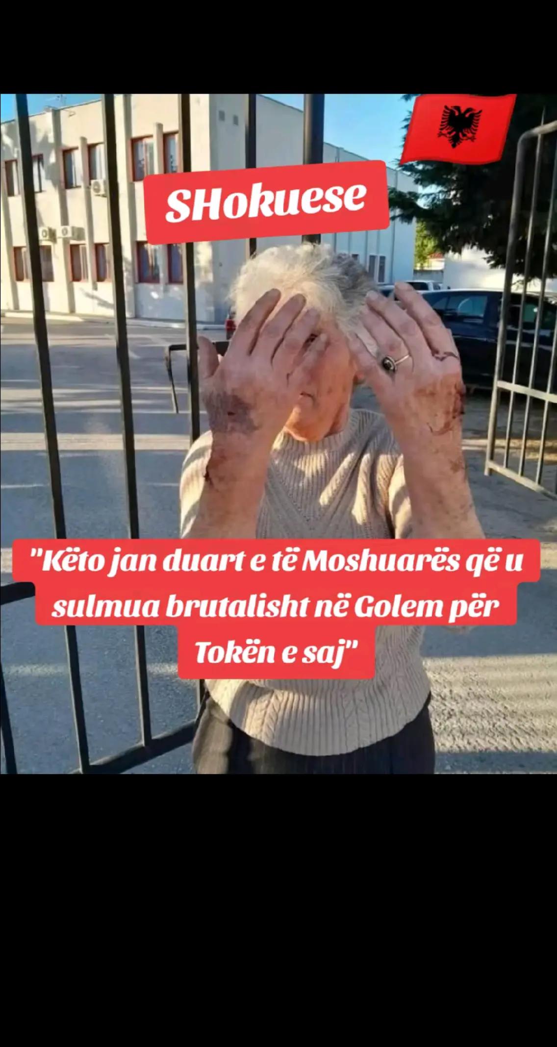 @🤯🇦🇱"SKIZOFRENI"🇦🇱🤯