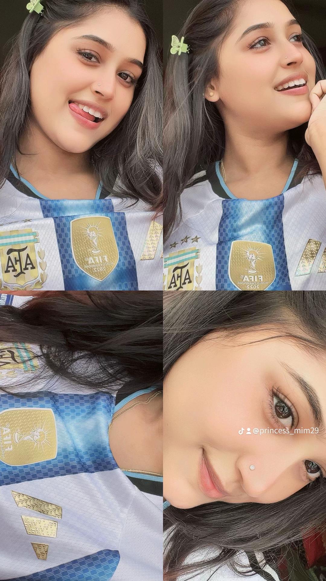 @🦋 MIM