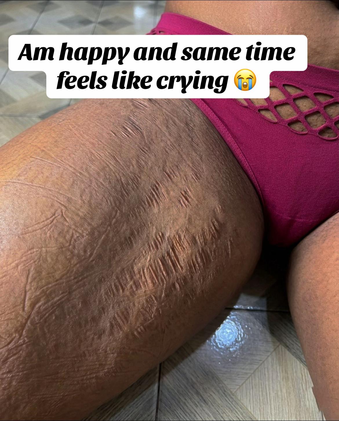 @Radiant skin