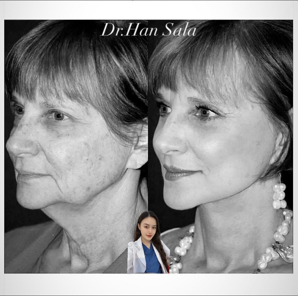 @Dr.Han Sala Beauty