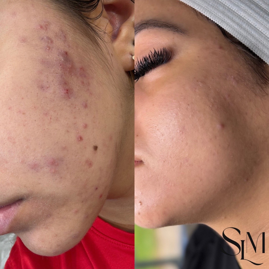 @Myrah | Midland Aesthetician