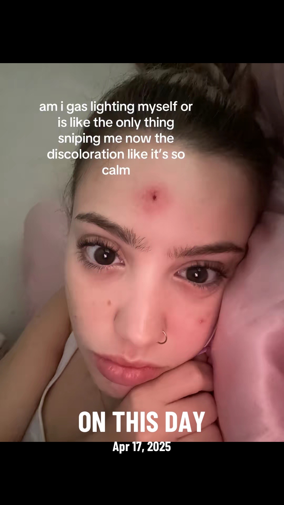 @cheeto🙈