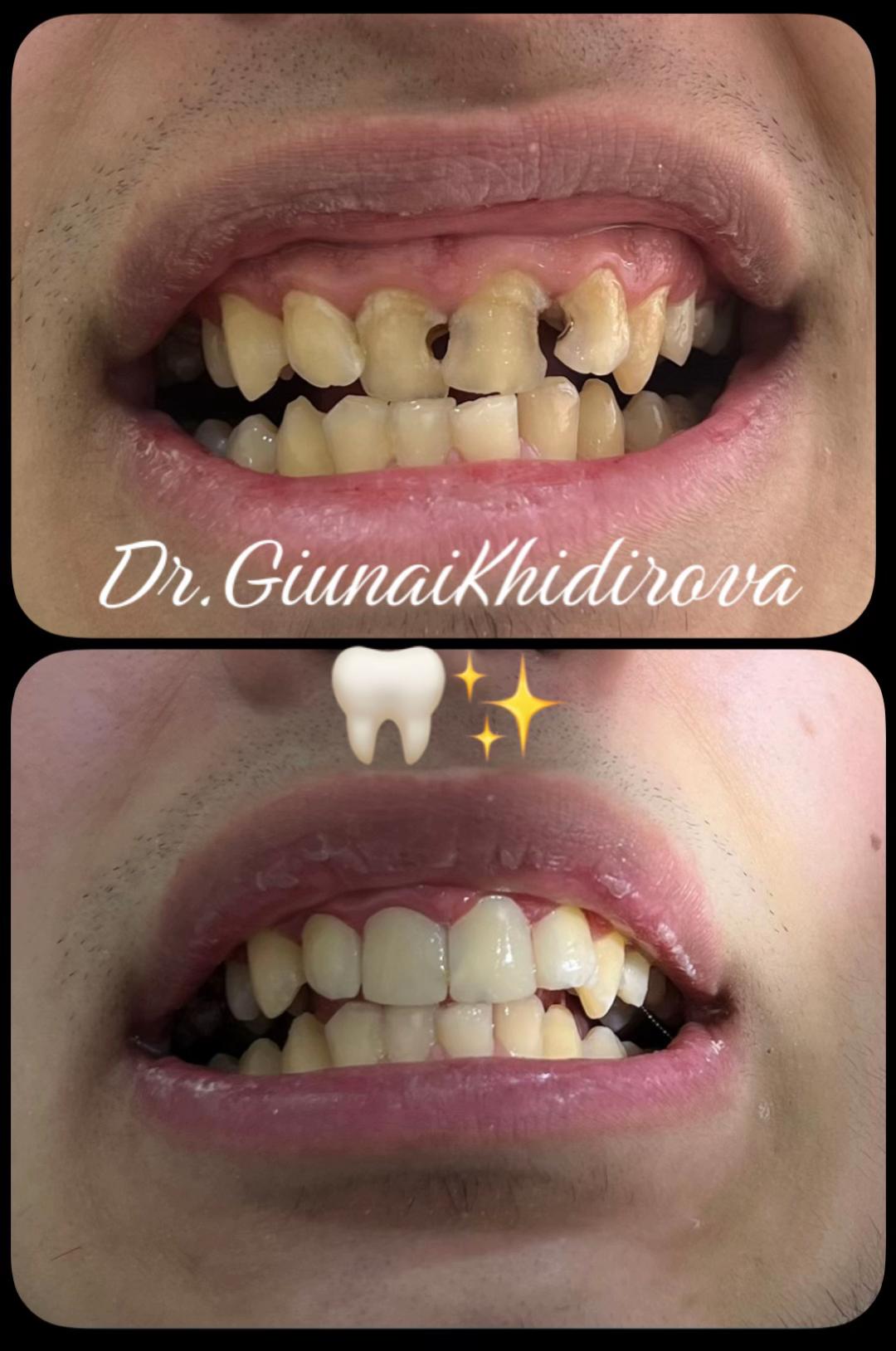 @Dr.Гюнай
